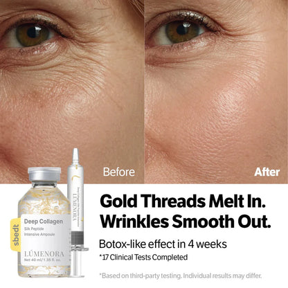 The Glass Lift Ritual